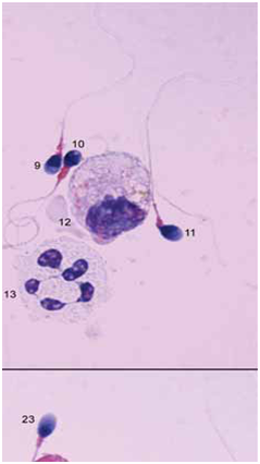 spermatozoi endoppmari 2
