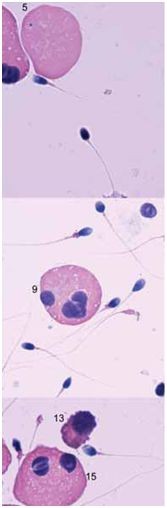 spermatozoi endoppmari 3