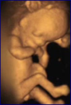 feto 3d primo trimestre
