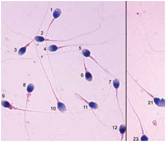 spermatozoi endoppmari 1
